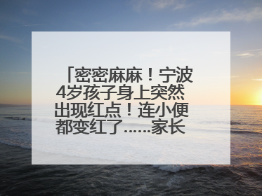 密密麻麻！宁波4岁孩子身上突然出现红点！连小便都变红了……家长：以为只是摔伤
